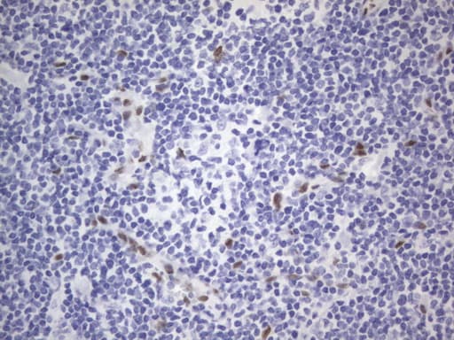 RBFOX1 / A2BP1 Antibody (aa1-210, clone OTI4F9)