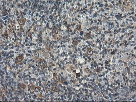 PFKP Antibody (clone OTI2F2, Carrier-free)