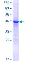 Human RWDD3 Protein (Recombinant GST)