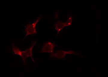 AGXT2 Antibody
