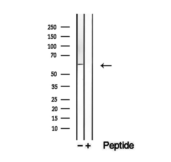 DHCR24 / Seladin-1 Antibody