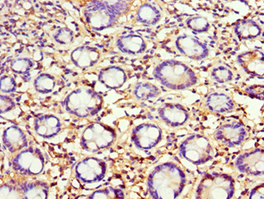 AGR2 Antibody (aa21-175)