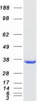 Human UCK1 Protein (Recombinant Myc-DDK (Flag))