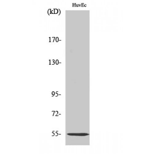 Polyclonal Rabbit anti-Human SERPING1 / C1 Inhibitor Antibody (320-400 aa, Internal, IHC, WB)
