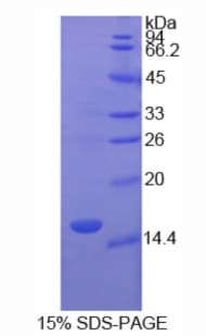 Human TNNT3 Protein (Recombinant His)