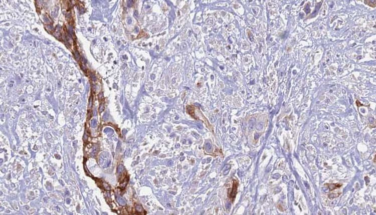 Polyclonal Rabbit anti-Human ATP6AP2 / Renin Receptor Antibody (IHC, IF, WB)