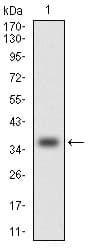 CCL2 / MCP1 Antibody (clone 2D8)