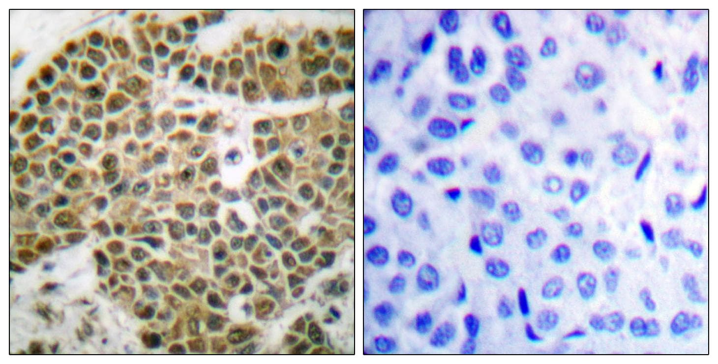 NFKB1 / NF-Kappa-B Antibody (p927)