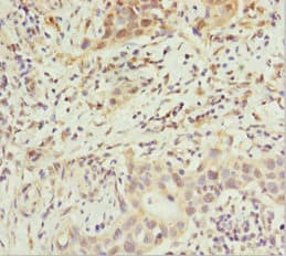 ABCB8 Antibody