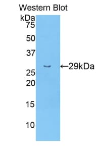 NRG1 / Heregulin / Neuregulin Antibody (aa13-259, Cy3)