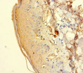 Polyclonal Rabbit anti-Human HTR2A / 5-HT2A Receptor Antibody