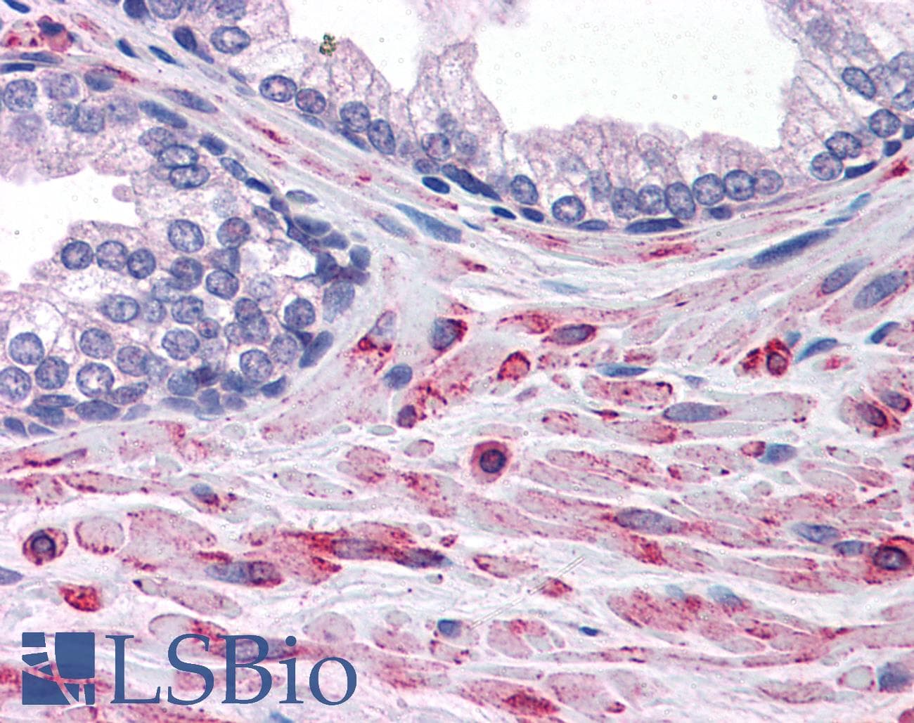 IHC-plus™ Polyclonal Goat anti-Human ELMO2 Antibody (aa707-720, IHC, WB)