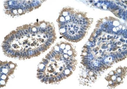 Polyclonal Rabbit anti-Human SHH / Sonic Hedgehog Antibody (N-Terminus, IHC, WB)