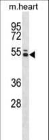 PTK6 / BRK Antibody (aa1-28)
