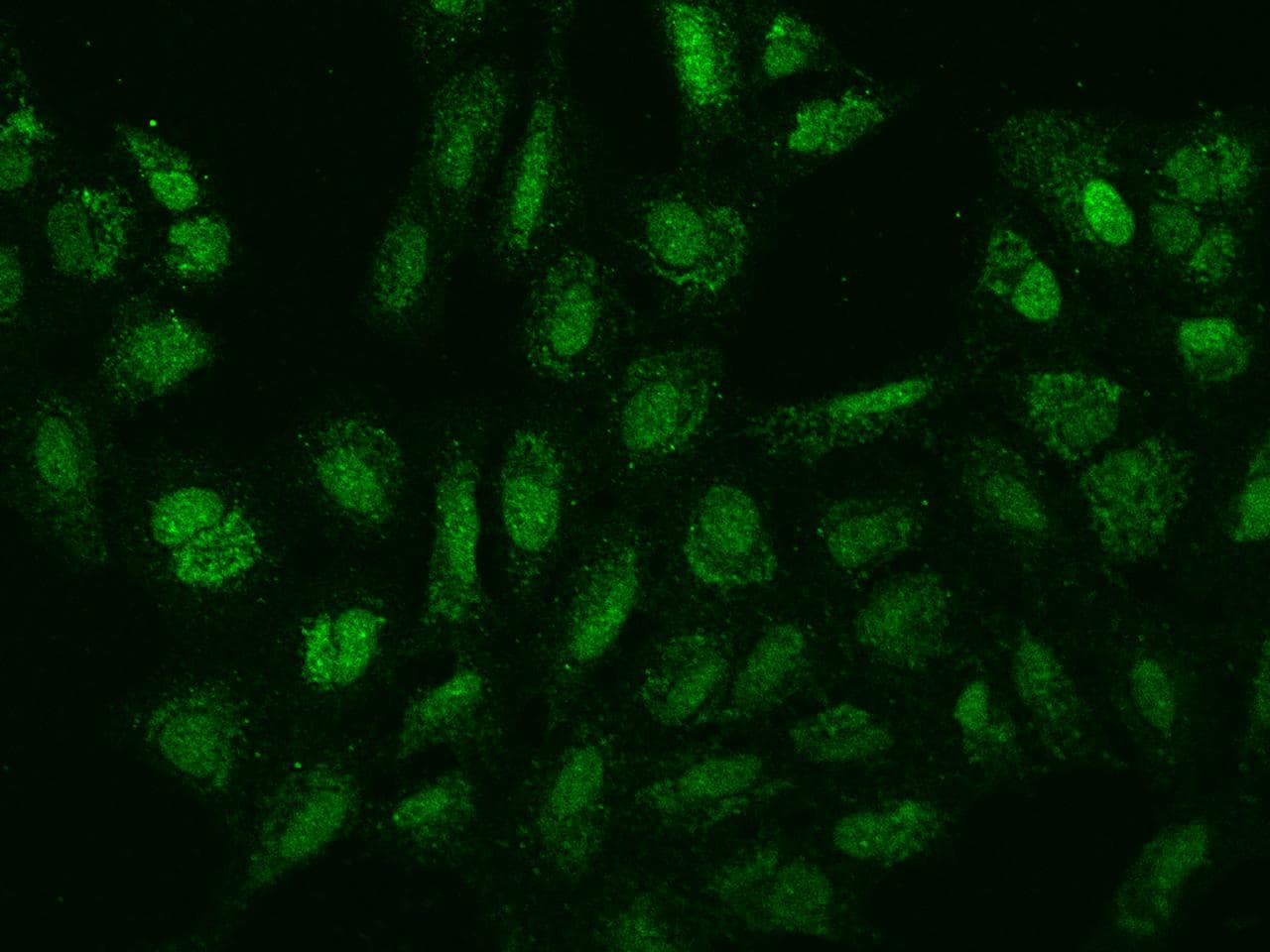 Polyclonal Rabbit anti-Human SPIN4 Antibody (IF)