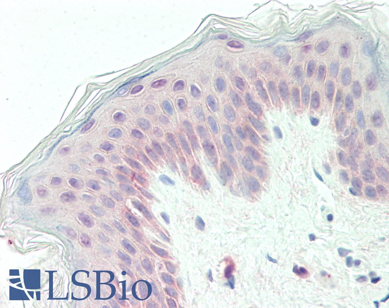 IHC-plus™ Polyclonal Rabbit anti-Human GPC1 / Glypican Antibody (Internal, IHC, WB)
