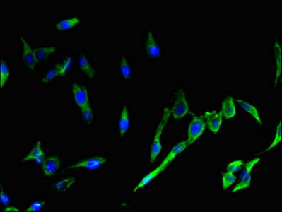 SH2D1A / SAP Antibody