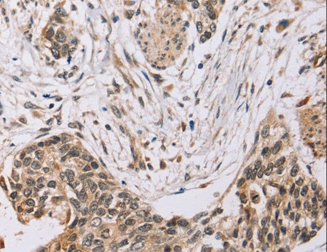 PDLIM7 / Enigma Antibody