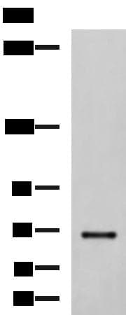 Polyclonal Rabbit anti-Human PREPL Antibody (IHC, WB)