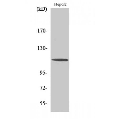 Polyclonal Rabbit anti-Human CLIP2 / CYLN2 Antibody (960-1040 aa, C-terminal, WB)