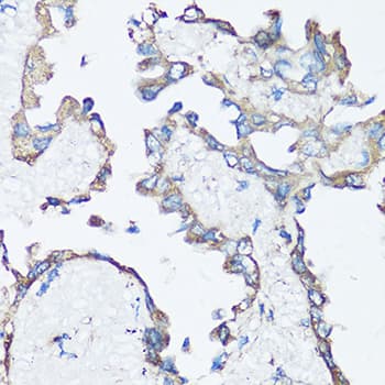 SRC Antibody