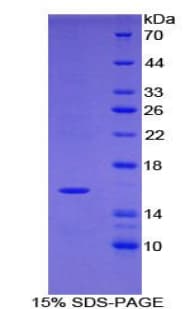 Human TPSD1 / Tryptase Delta 1 Protein (Recombinant His-S)