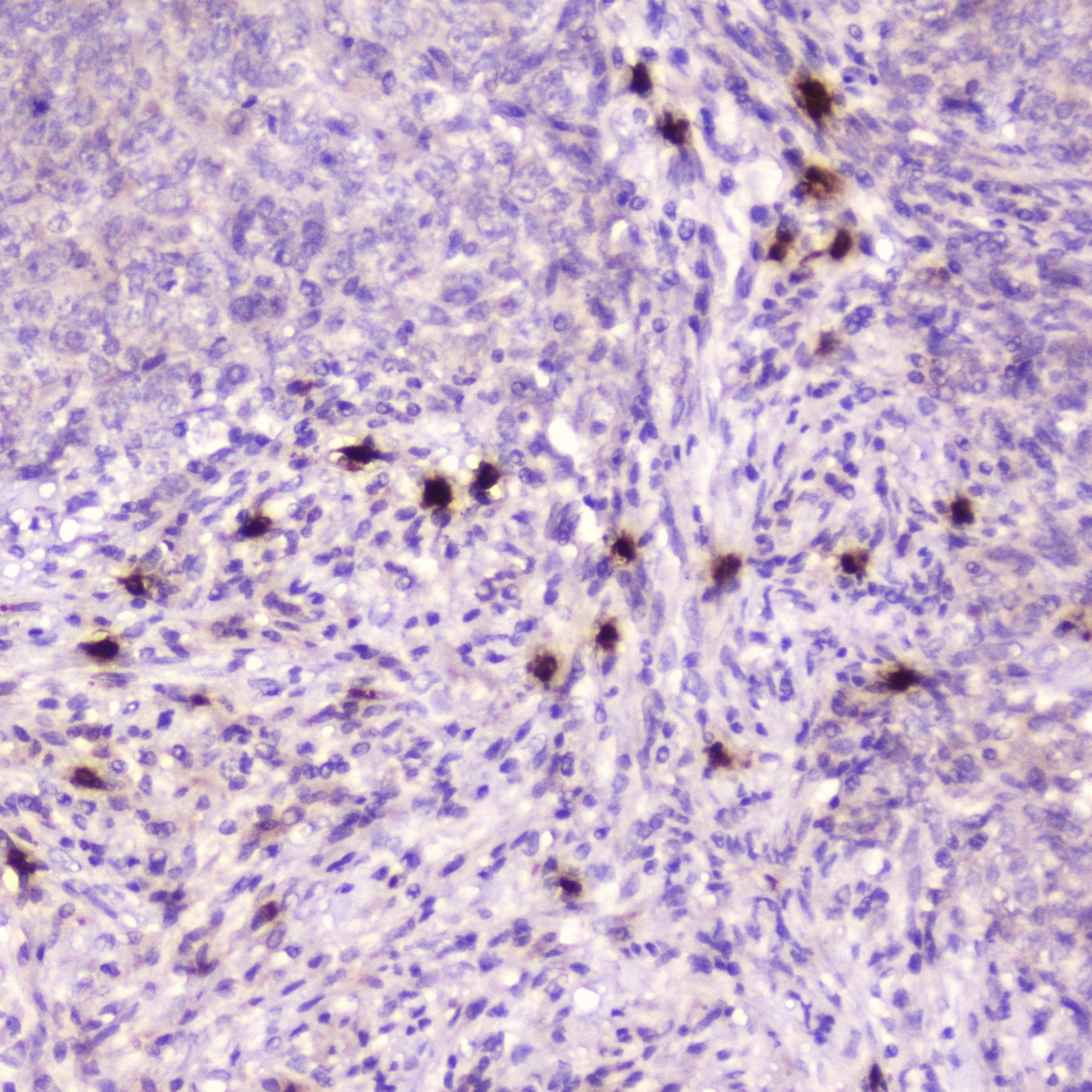 RNASE3 Antibody