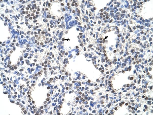 Polyclonal Rabbit anti-Human SRSF10 / FUSIP1 Antibody (C-Terminus, IHC, WB)