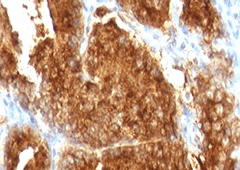 AMACR / P504S Antibody (clone 2MACR-1)