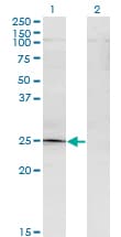 TGIF2 Antibody (clone 2A4)