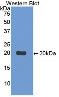 CD30L / CD153 Antibody (aa60-227)