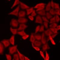 SMYD5 Antibody