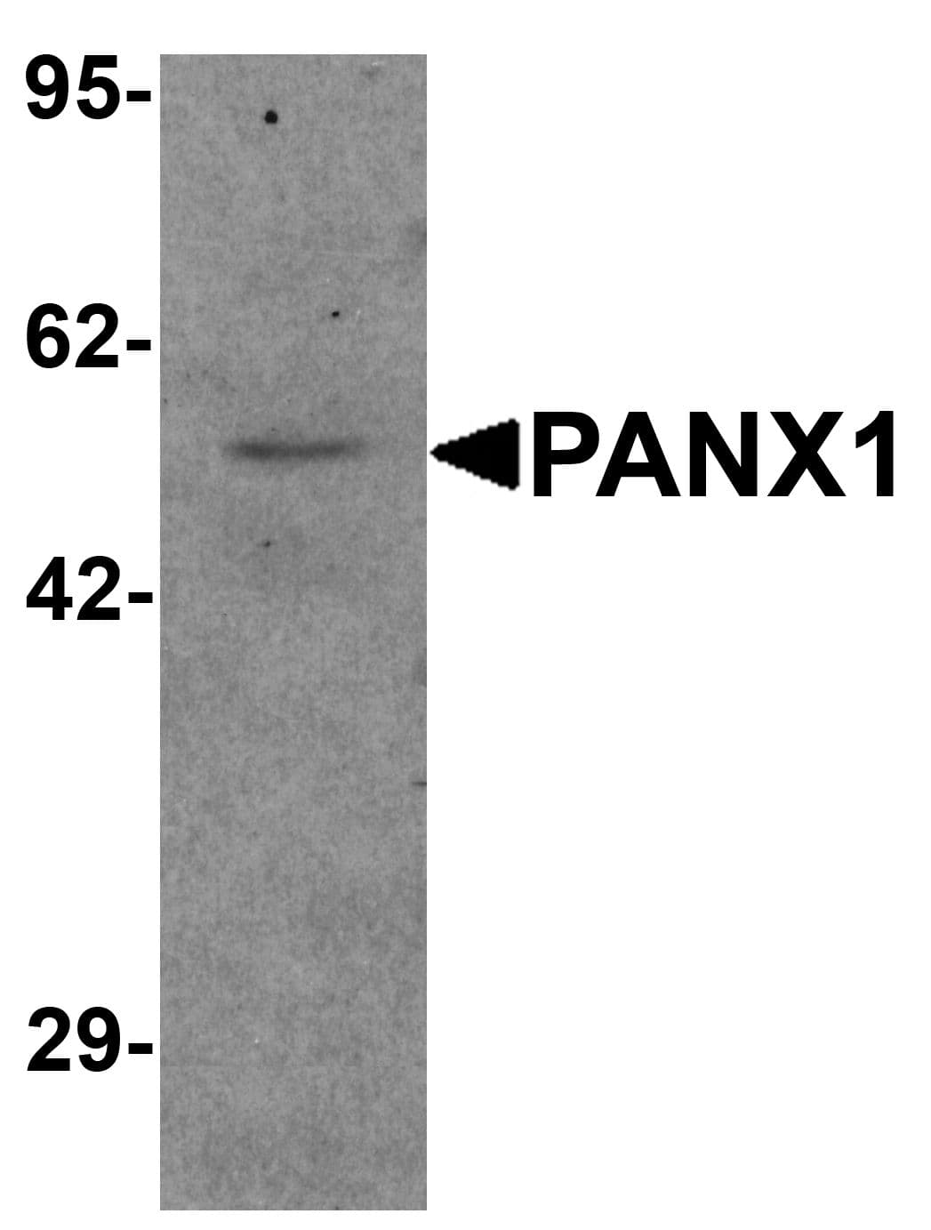 Polyclonal Rabbit anti-Human PANX1 / Pannexin 1 Antibody (IF, WB)