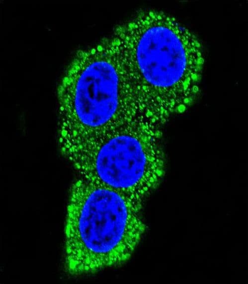 CD28 Antibody (aa182-208)