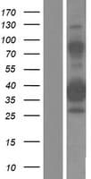 ZNF367 Protein (Over-Expression Lysate Myc-DDK (Flag))