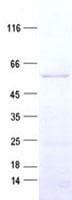 Human MICU1 / CBARA1 Protein (Recombinant His, N-Terminal)