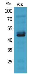 NCR2 / NKP44 Antibody