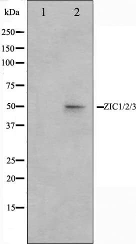 ZIC / ZIC1 Antibody