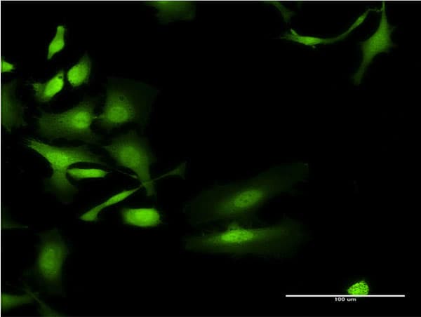 UGT2B4 Antibody (clone 2H6)