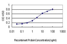 Monoclonal Mouse anti-Human TBXT / T / Brachyury Antibody (clone 5H8, WB)