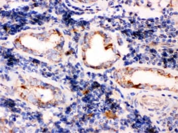 TPP1 / CLN2 Antibody