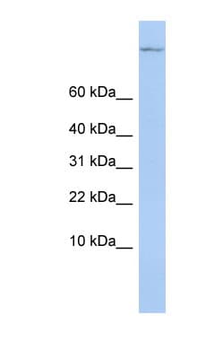 TSC22D1 / TSC22 Antibody (C-Terminus)