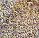 BRCTD1 / ANKRD32 Antibody (aa159-188)
