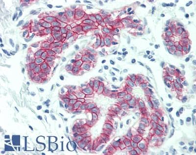 IHC-plus™ DSG2 / Desmoglein 2 Antibody