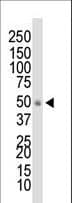 DOK1 Antibody (aa9-39)