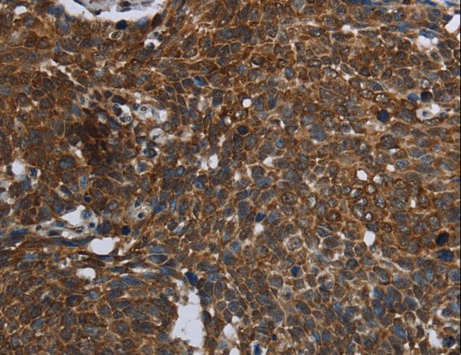 Polyclonal Rabbit anti-Human FASTKD2 Antibody (IHC, WB)
