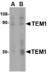 TEM1 / CD248 Antibody