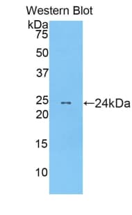 MRLC2 / MYL12B Antibody (aa5-172, FITC)