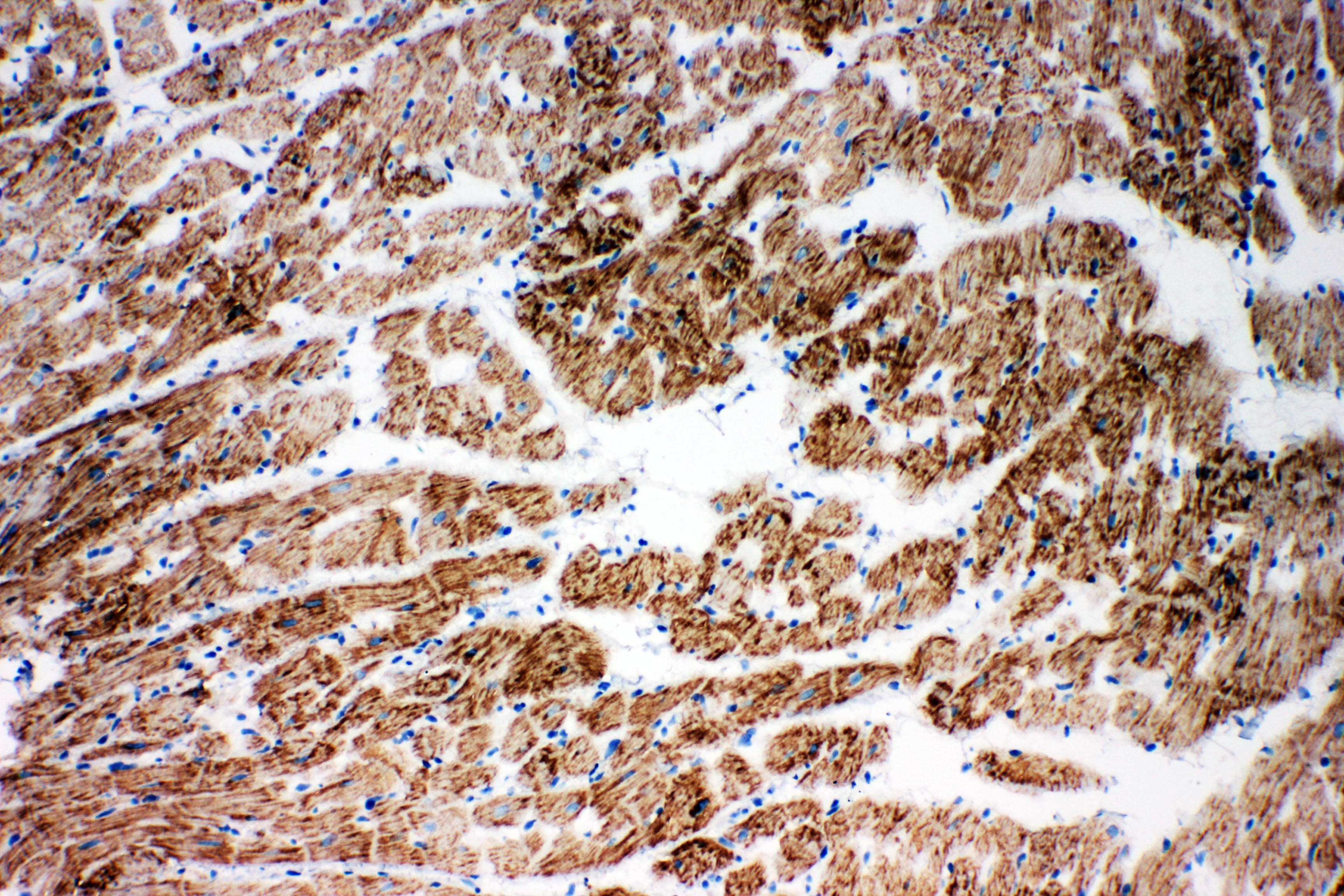 Polyclonal Rabbit anti-Human NDUFA1 Antibody (aa54-70, IHC, WB)
