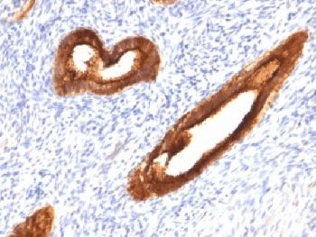 EMA / MUC1 Antibody (clone MUC1/520, Ready-to-Use)